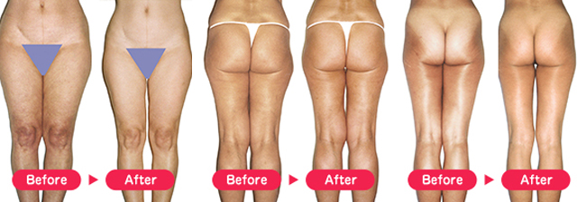 before_after.jpg